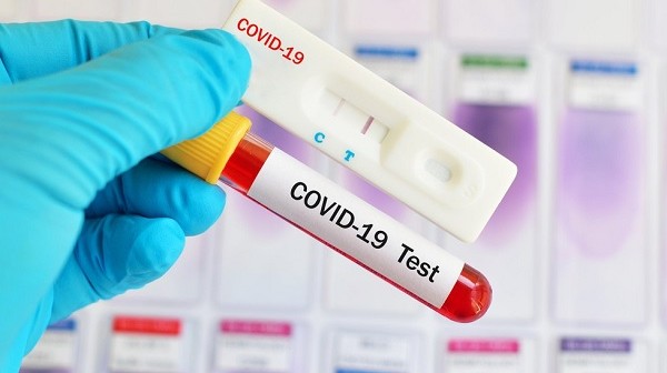 teste-exame-covid-coronavirus